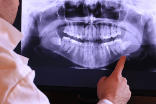 Best Emergency Dental Care for Abscessed Tooth in Dewart, PA